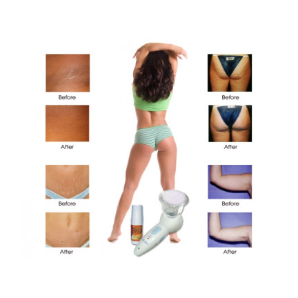 AS23 CELLULESS MASAŻER 